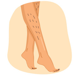 Unshaved hairy female legs vector illustration. Body positive normalize female body hair concept
