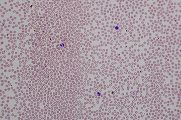 Characteristics Tissue of Thyroid gland, Lymph gland, Larynx of human and Human blood cells study...