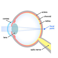 軸性遠視の眼球のイラスト