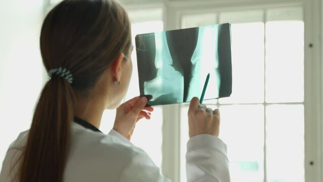 A young female doctor holds an X-ray in her hands and carefully examines the picture against a background of white light. 