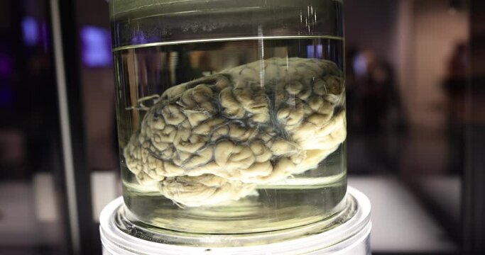 Human brains in formaldehyde jar lab