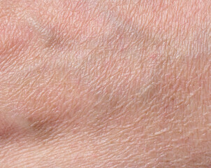 White person skin texture