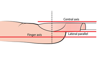 Illustration with hardware manicure technology. Correct nail shape. Educational material on vector