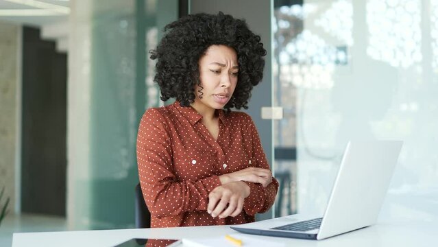Allergy attack Itch or pruritus. African american female scratching suffering from allergic reaction or mosquito bite sitting in office. Black woman has scabies or as a result of stress scratches body