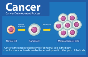Foto op Plexiglas Processing of Cancer Cells: An Infographic Exploration © GraphicsRF
