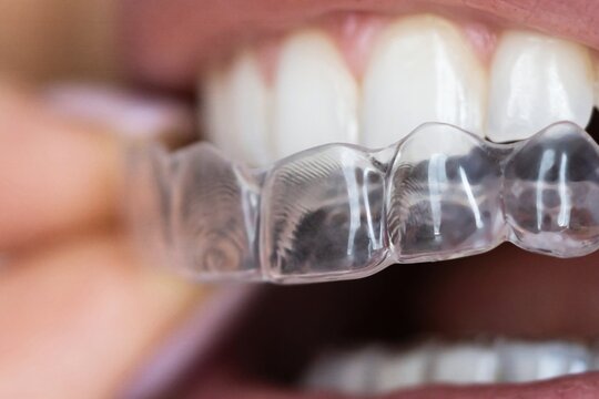 Clear Dental Aligners - Night Guard