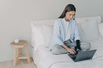 Professional multitasking at home with a bionic prosthetic arm