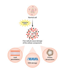 Oxidative stress. Free radicals cause oxidation of the cellular membrane proteins and lipids, and damage of the cellular components. vector illustration