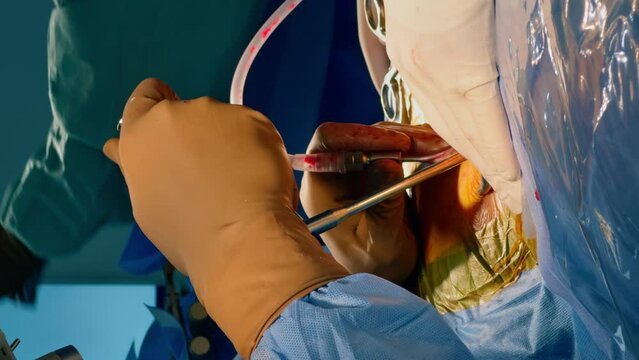 Surgeon's hands in brown latex gloves performing operation. Doctor applies the variety of tools in procedure. Close up. Vertical screen.