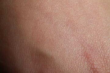 Fototapeta premium Closeup view of dry human skin as background