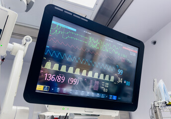 Hospital monitor displaying vital signs: heart rate, blood pressure, oxygenation, temperature, and end-tidal CO2, crucial for patient care and health assessment