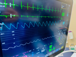 Hospital monitor displaying vital signs: heart rate, blood pressure, oxygenation, temperature, and...