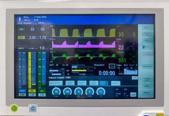 Hospital monitor displaying vital signs: heart rate, blood pressure, oxygenation, temperature, and...