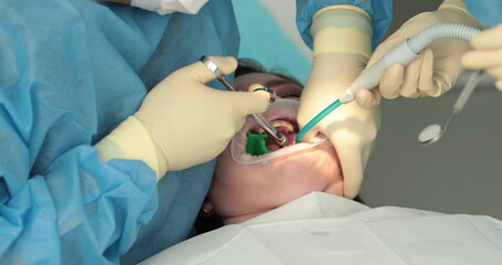 Obraz na płótnie Canvas Dental treatment close-up. A dentist performs a dental procedure. Dentist's hands at work. Oral cavity in the process of treatment at the dentist.