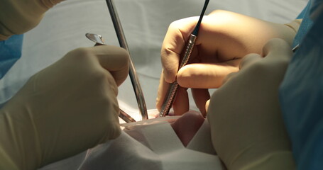 Dental treatment close-up. A dentist performs a dental procedure. Dentist's hands at work. Oral cavity in the process of treatment at the dentist. - obrazy, fototapety, plakaty