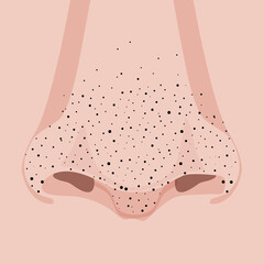 Front of the face nose with blackheads or black dots or acne pimples, illustration close-up