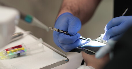 Doctor's hands with a working tool. Preparation and process of dental treatment. Dental instrument...