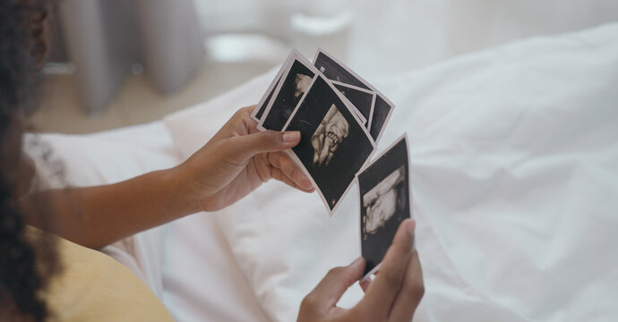 Intimate Glimpse into Motherhood, Cherishing the First Images of Life