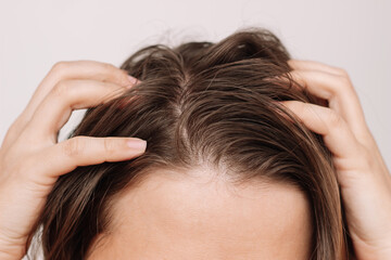 Cropped shot of a young woman with dirty greasy hair on a white background. The problem of oily scalp. Itching of the skin from long non-washes of the head