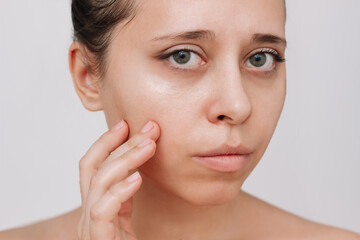 Young caucasian woman with greasy skin touching the face with her hand isolated on a white...