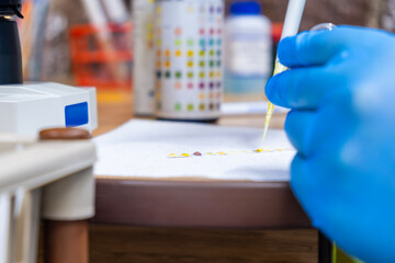 Doctor dripping urine from a pipette onto test strip test or labstix for urine infection. Urina test in medical laboratory to analyze Protein, Leukocytes, Urobilinogen, Bilirubin, Blood, Nitrite, pH