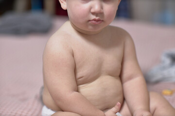 Roseola is the beginning of the course of the disease in the baby, there are barely noticeable...