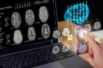 finger press air. screen brain scan laptop UI for check brain tissue in pieces