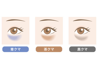 目のクマの種類