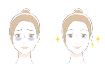 目のクマ　ビフォーアフター