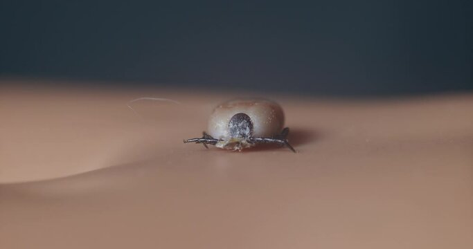 Macro close up of tick on human skin. Static, shallow focus