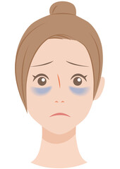 目にクマのある女性　青クマ