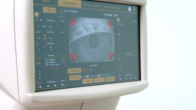 The doctor controls the optometrist's display using the scanned eye. diagnostic ophthalmological equipment. Concept of consultation and correction in an ophthalmology clinic.