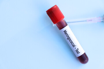 Meningococcal test to look for abnormalities from blood