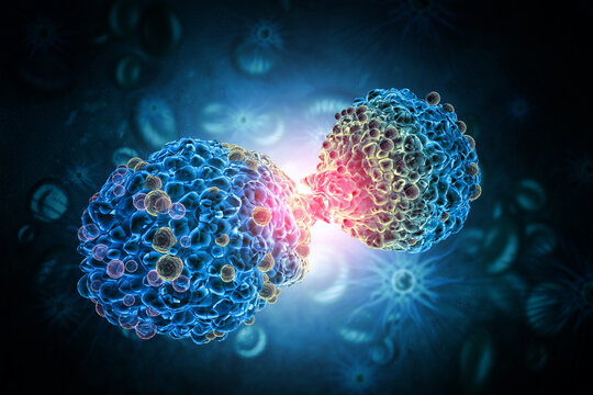 Cancer cells. Cancer outbreak and treatment for malignant cancer cells in a human body. 3d illustration