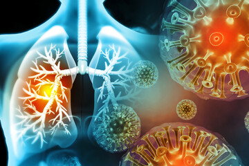 Virus and bacteria infected the Human lungs. lung disease.3d render