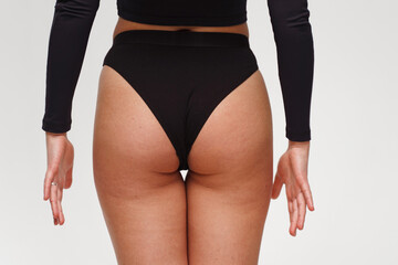 A woman with a beautiful feminine figure in black lingerie with overweight, cellulite and stretch...