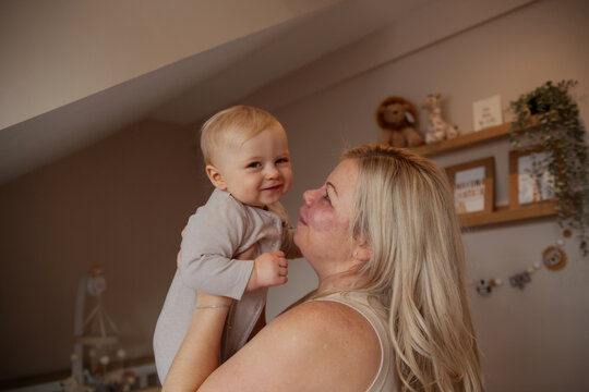 Young blonde mother with facial birthmark holding happy baby
