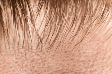 The Hair line on the man forehead - macro close up
