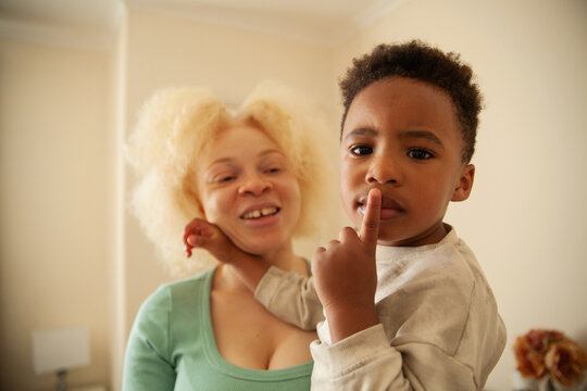 Young African woman with albinism holding moody son in living room looking into camera