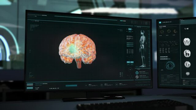Computer diagnostic software deals with the organ examination . Computer diagnostic tech is examining the brain. Computer diagnostic system has found a deadly tumor after the brain examination. UI.