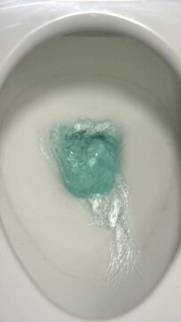 a toilet seat