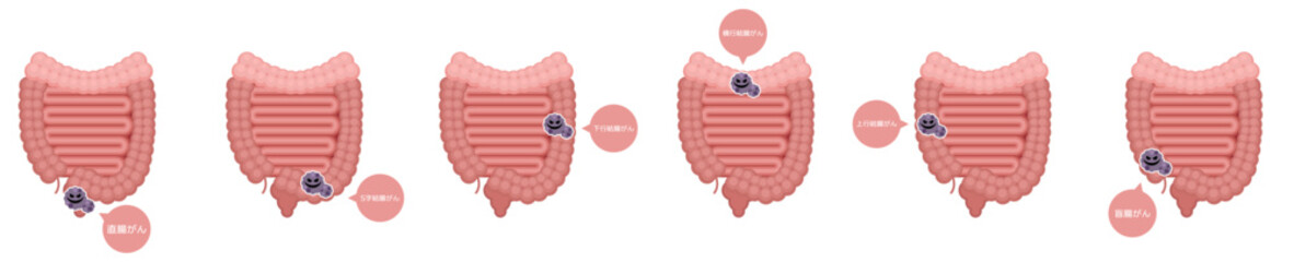 腸のがんセット※Affinity Designer作成svgファイル