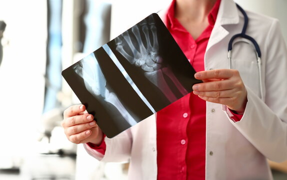 Female radiologist hold in hand x-ray film image aganist hospital office background. CT scan of bone health concept.