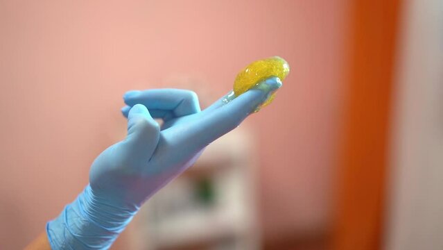 Sugar paste on a hand in blue glove. Poster, copy space. Sugaring salon