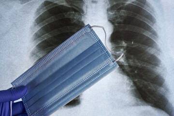 a hand in a blue medical glove holds a medical mask against the background of an X-ray of the lungs