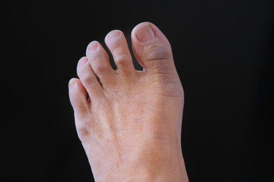 Close up shot of a man's left foot over dark background