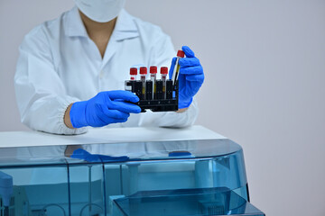 Female medical technologist using diagnostic equipment in cancer hospital lab in Asia
