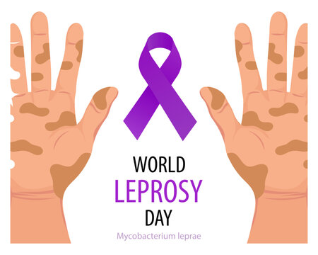 World leprosy day banner with hands and purple awareness ribbon. Healthcare and medicine. Vector