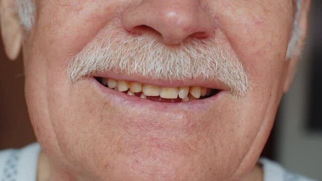 Close-up macro shot of toothless male smile mouth of senior mature man. Dental problem, bad teeth loss. Pensioner grandfather guy showing rotten teeth, caries, decayed, weak enamel, teeth falling out
