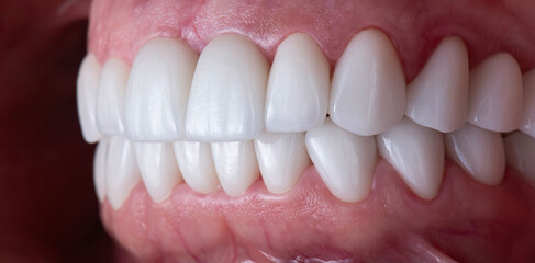 dental treatment pictures